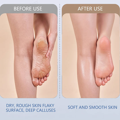 Electric Foot File – Rechargeable Callus Remover | AuriGlam